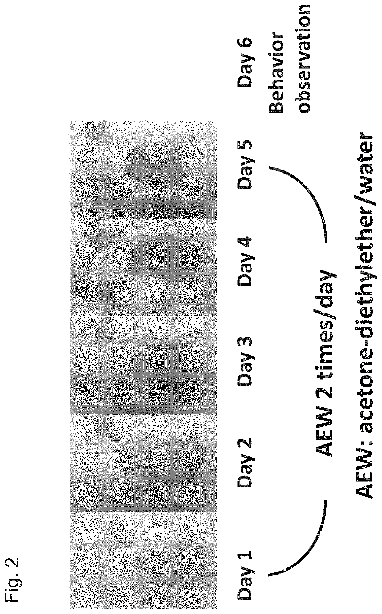 Antipruritic agent using pac1 receptor antagonist