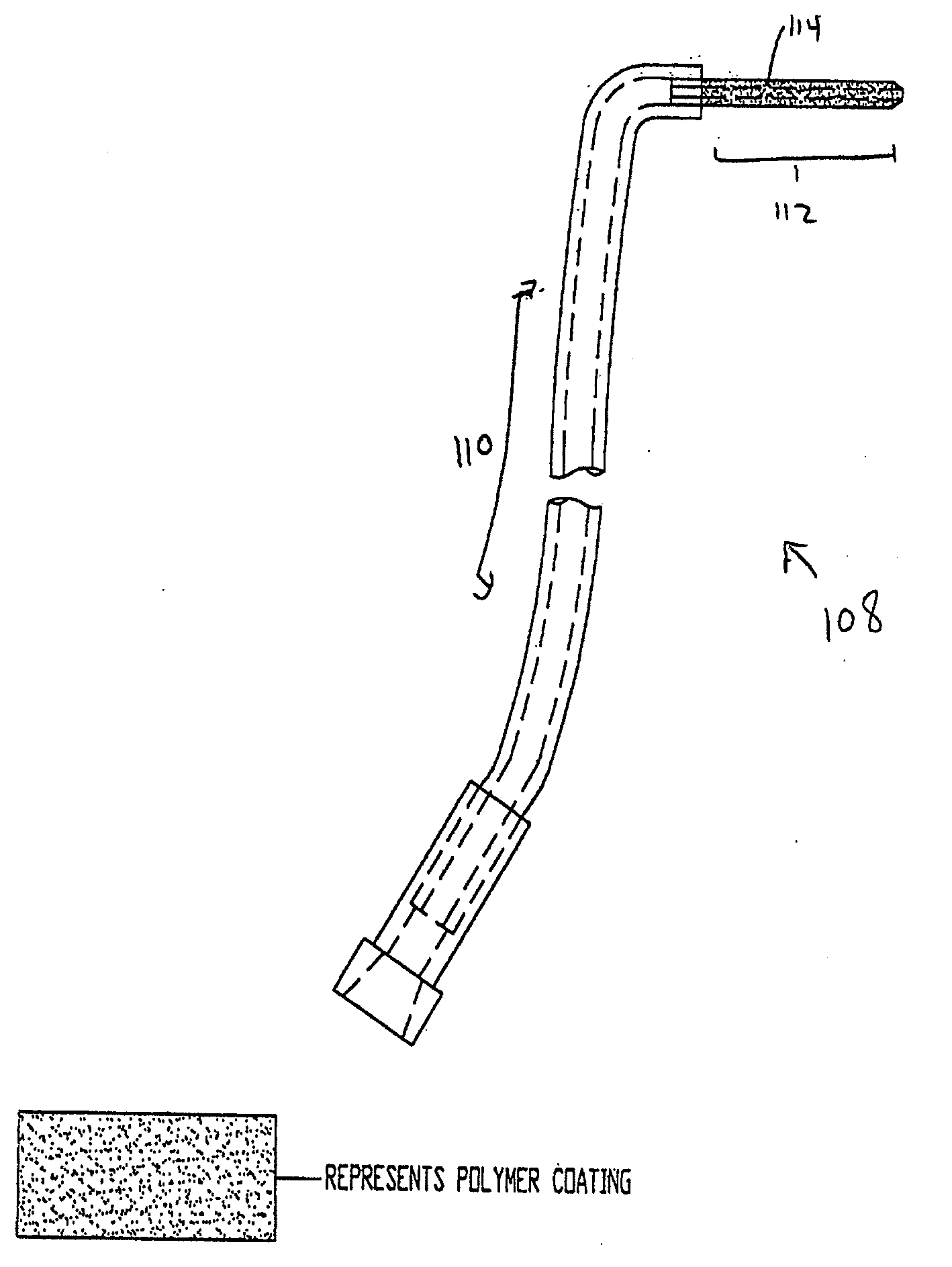 Coated Tracheostomy Tube and Stoma Stent or Cannula