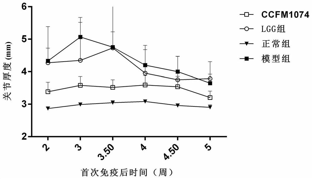 A strain of Lactobacillus casei that can alleviate rheumatoid arthritis and its application