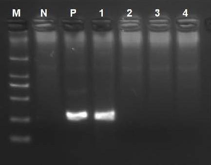 RDA method and kit for rapidly detecting influenza A virus