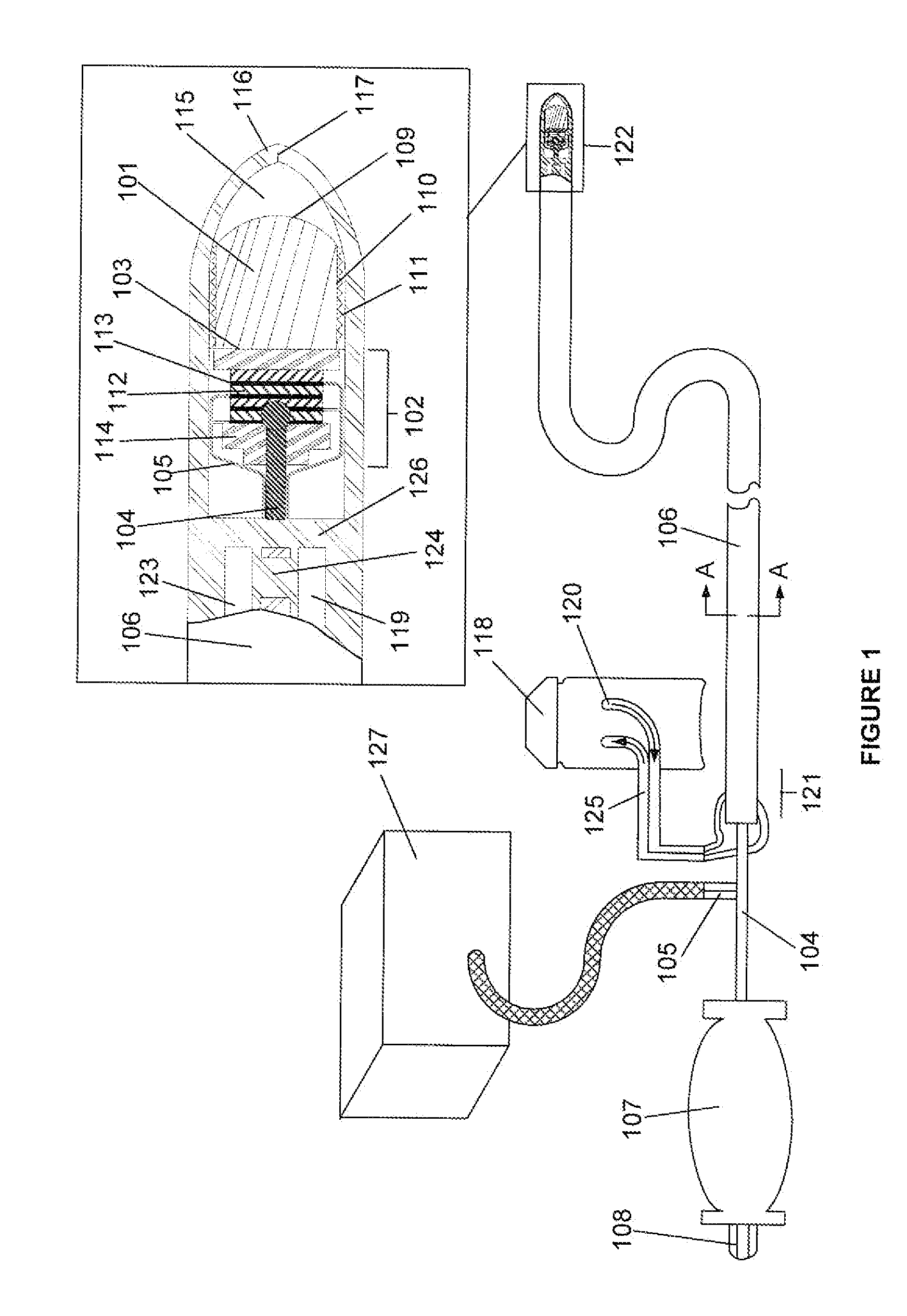 Ablative ultrasonic-cryogenic methods