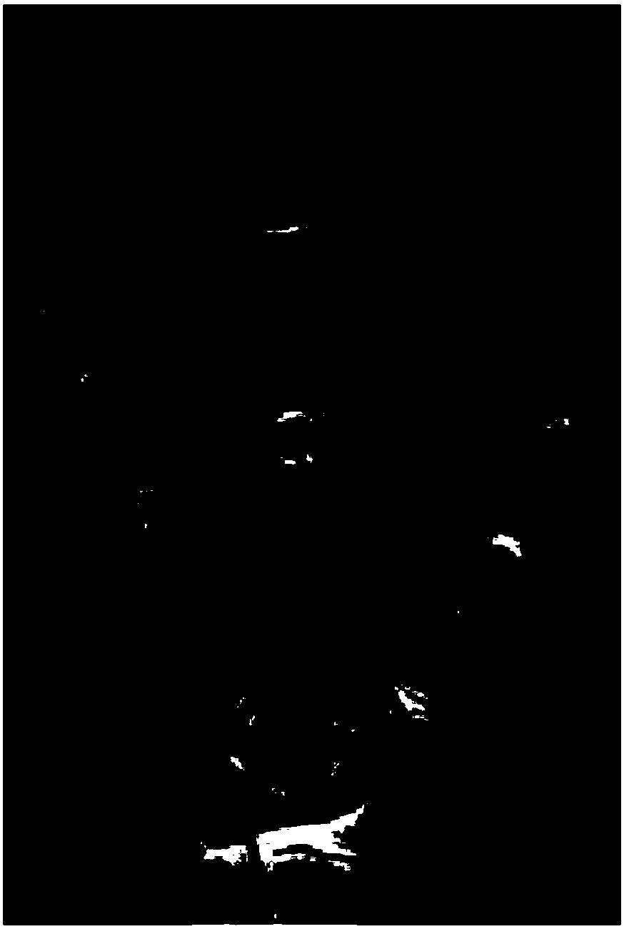 Method and device for detecting bone age