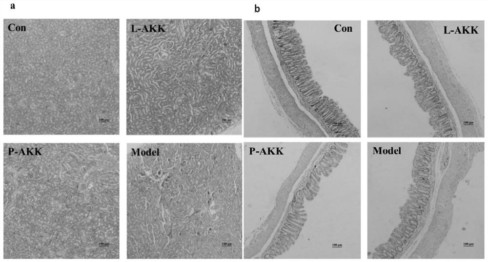 Application of ackermania muciniphila in relieving hyperuricemia