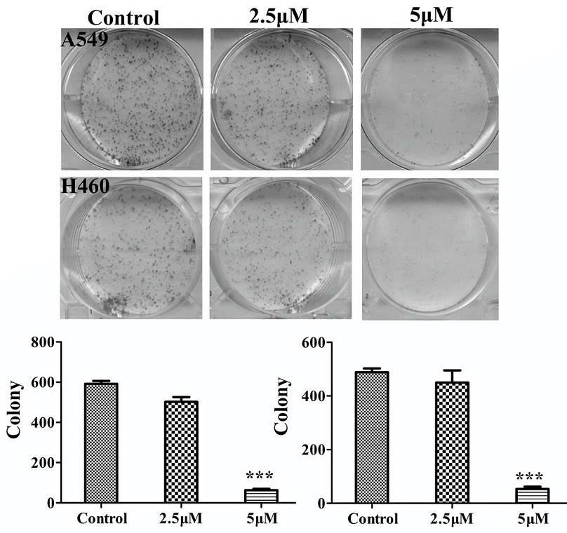 Application of a spider cytotoxic active peptide in the research and development of antitumor drugs