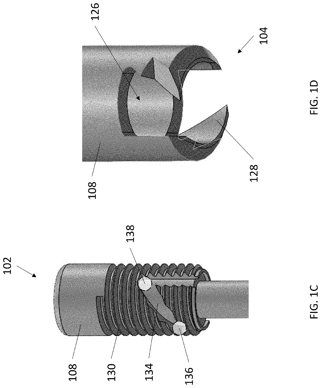 Minimally Invasive Subdural Evacuating System