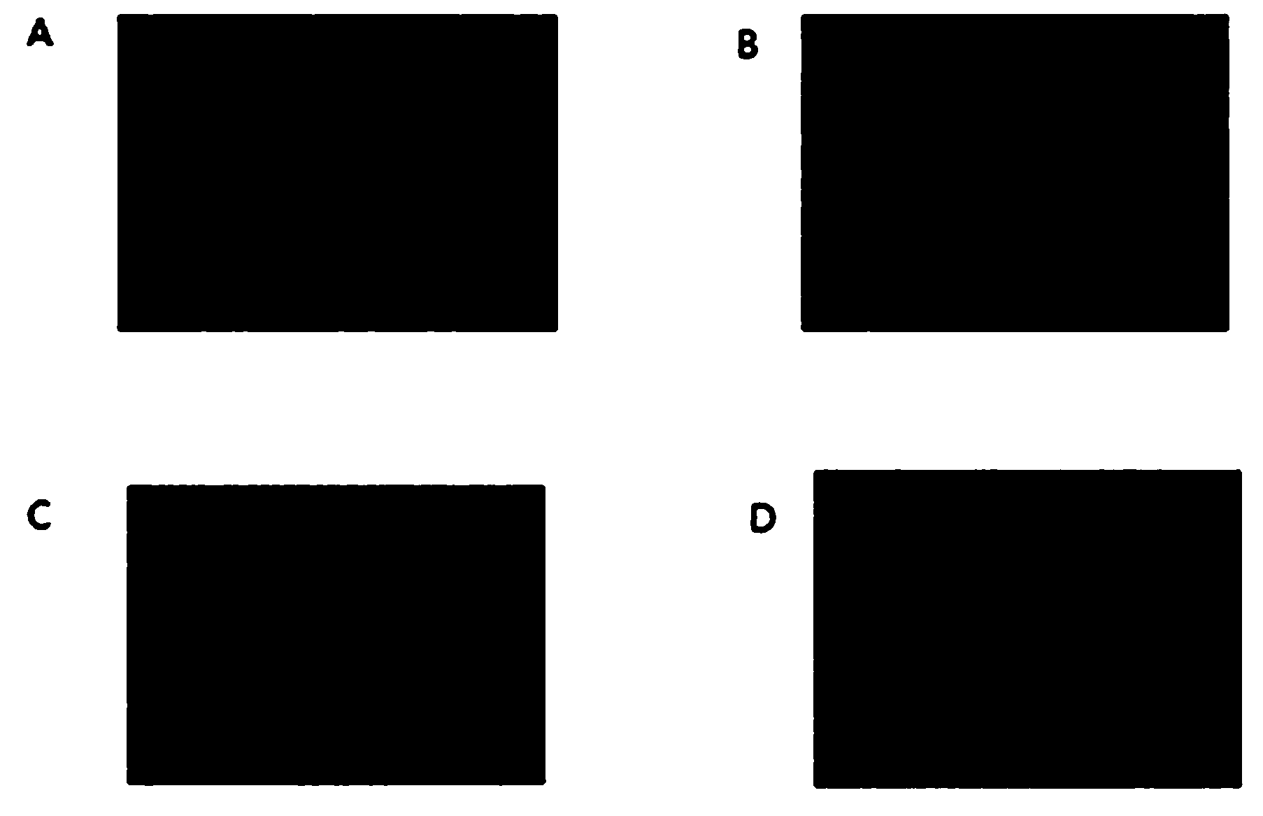 Pharmaceutical composition comprising nelumbo nucifera seed extract as active ingredient for protecting brain nerve cells