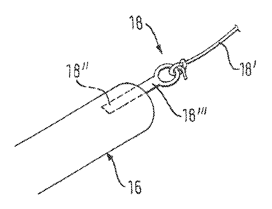 Retractable catheter