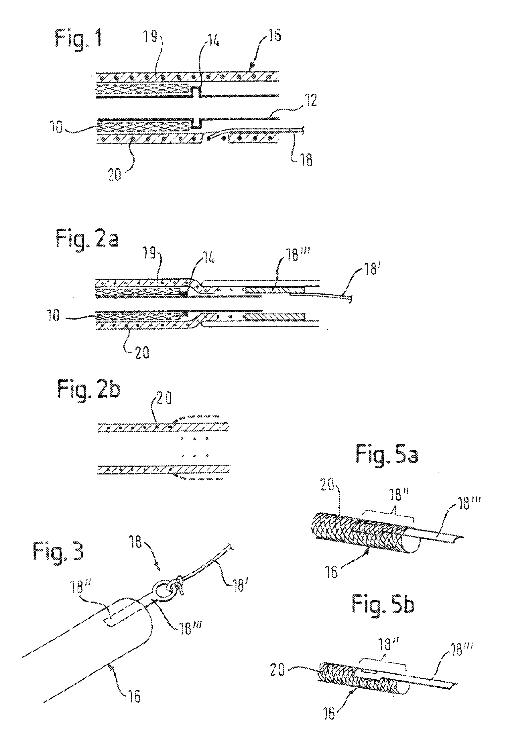 Retractable catheter