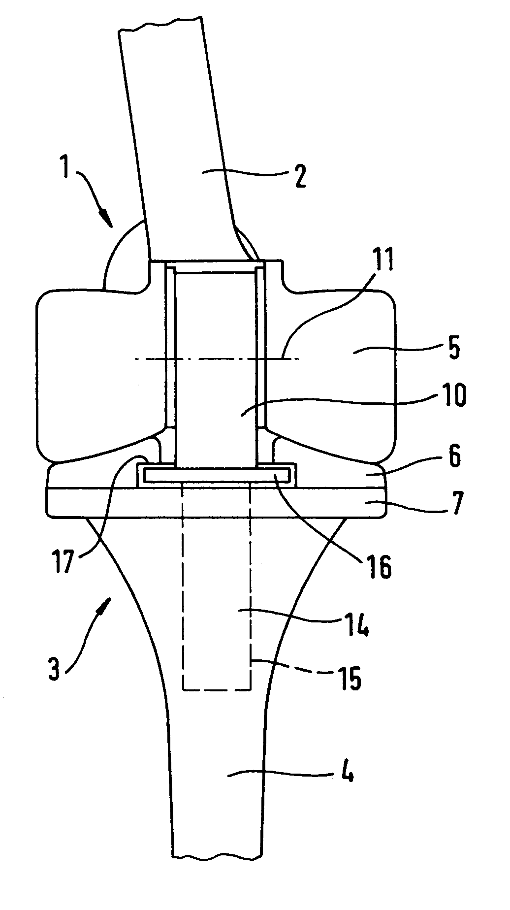 Knee prosthesis with rotation bearing