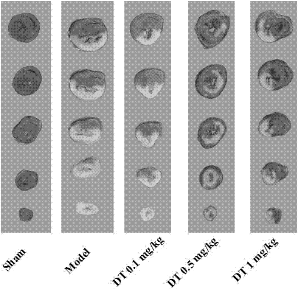 Pharmaceutical composition for treating myocardial infarction