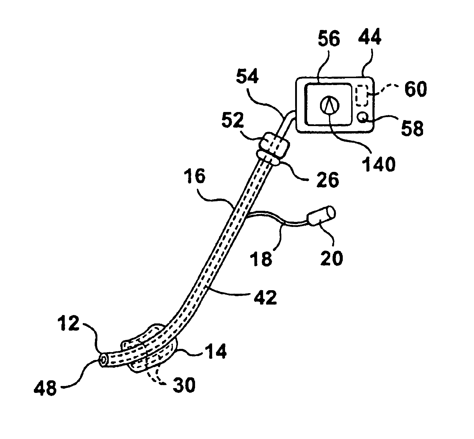 Apparatus for intubation