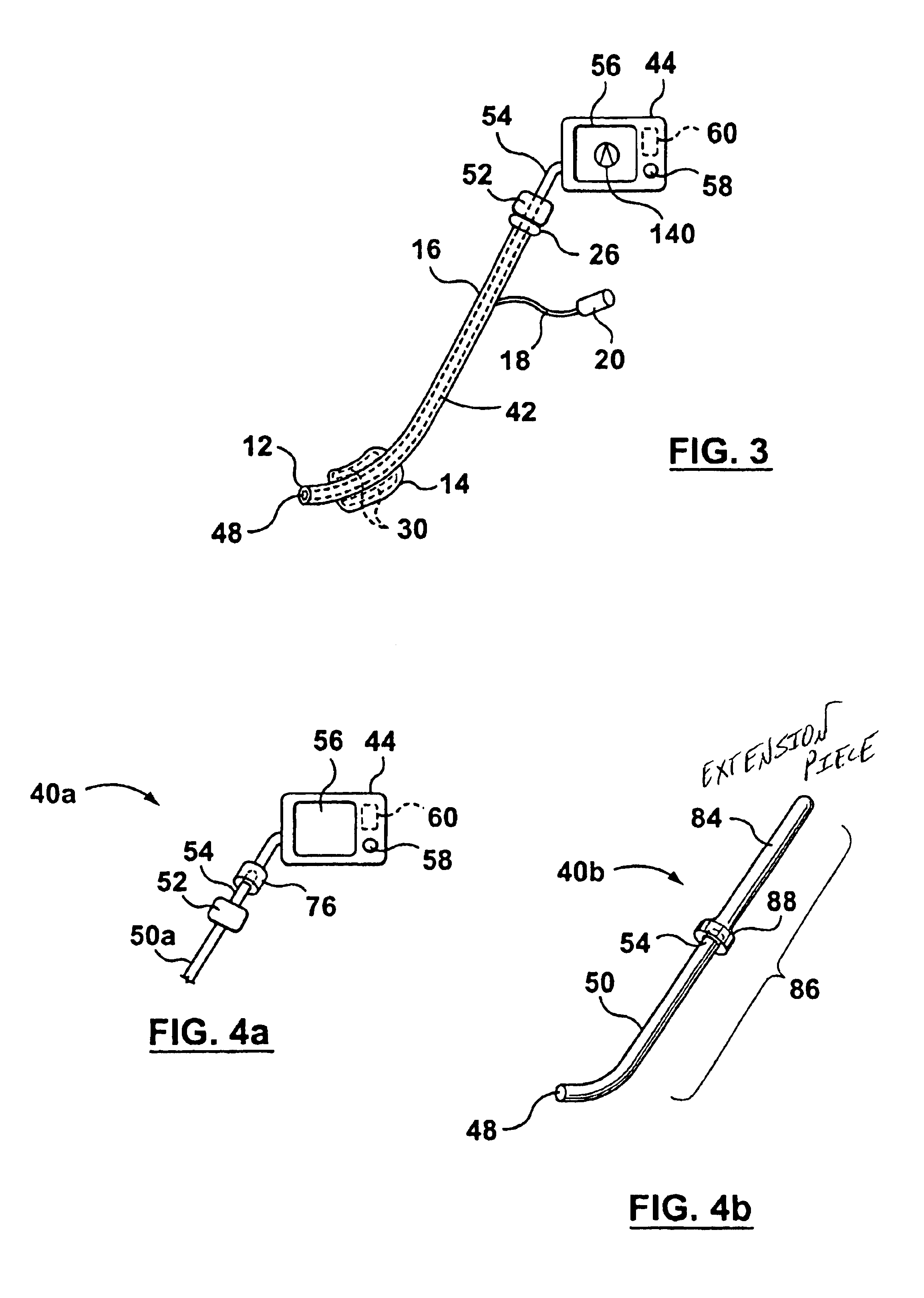 Apparatus for intubation