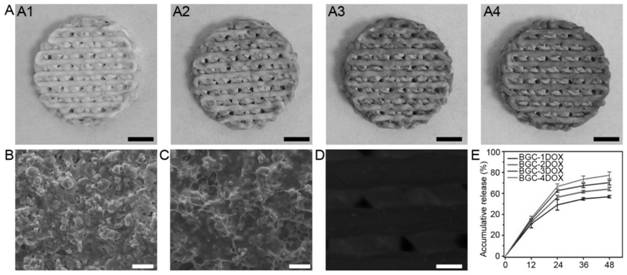 Multifunctional compound stent as well as preparation method and application thereof