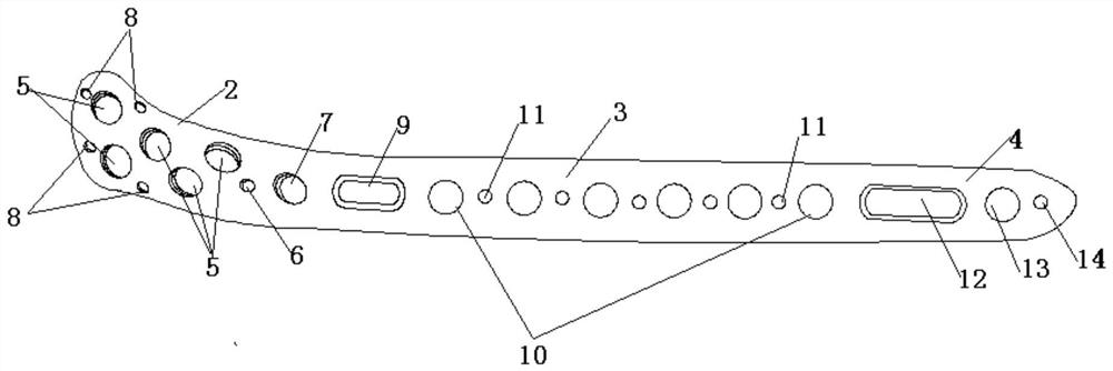 Tibia near-end outer side bone fracture plate