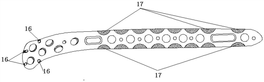 Tibia near-end outer side bone fracture plate