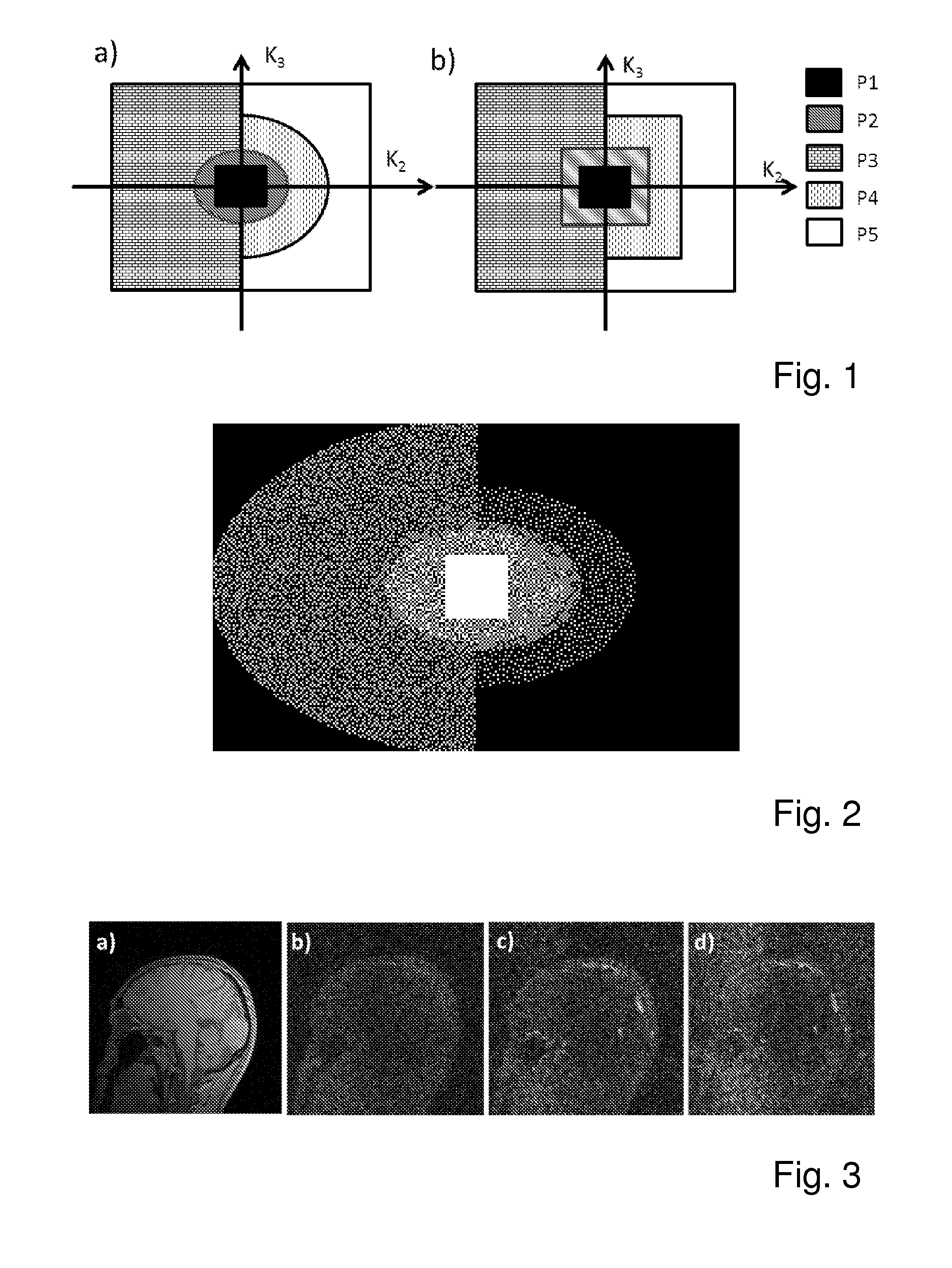 Method for magnetic resonance imaging