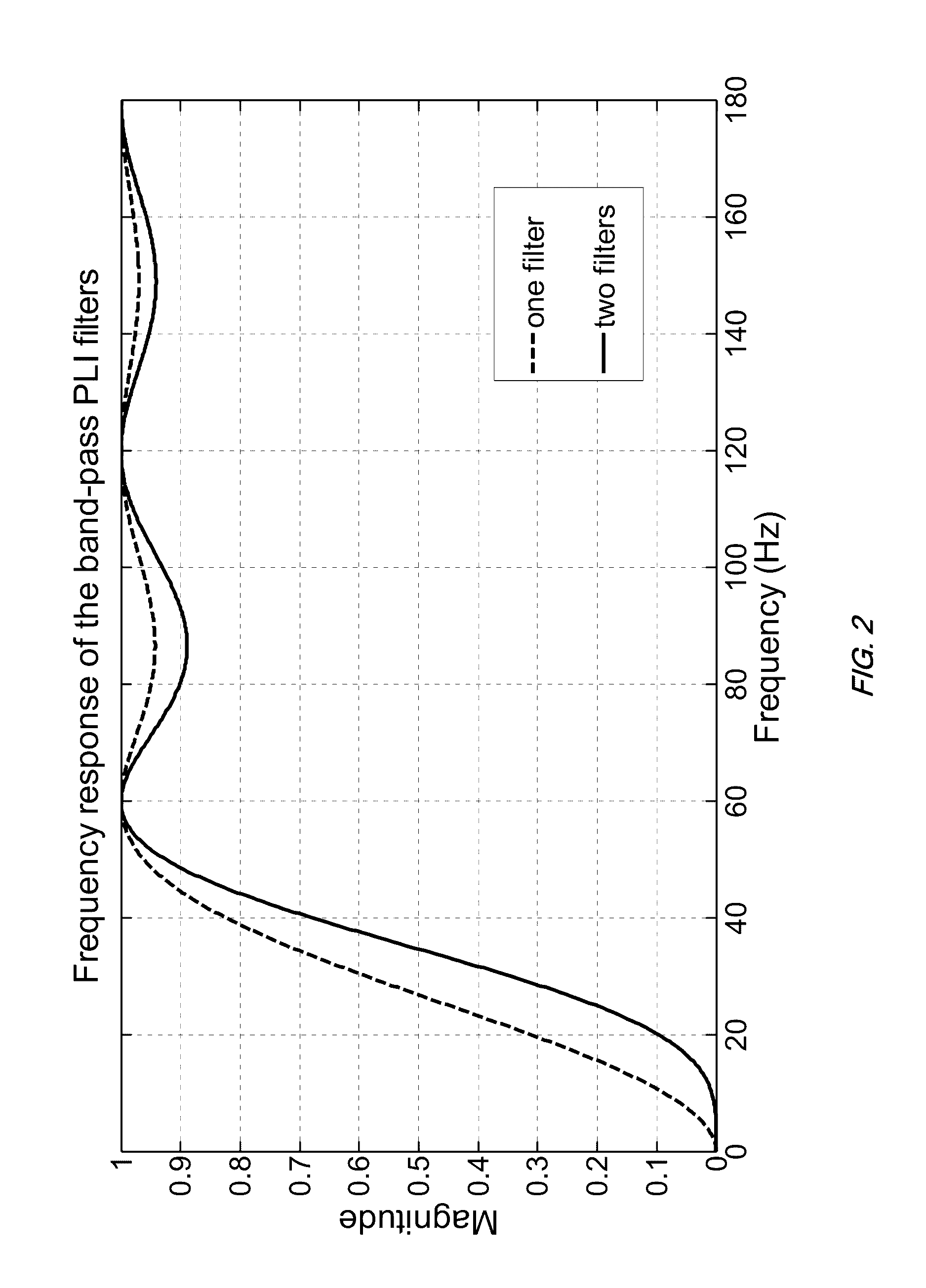 Technique for real-time removal of power line interference in ECG