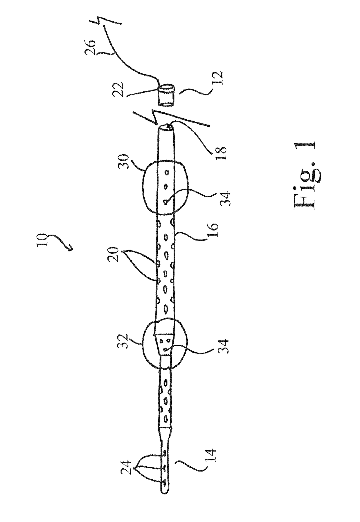 Systems and methods for selective auto-retroperfusion along with regional mild hypothermia