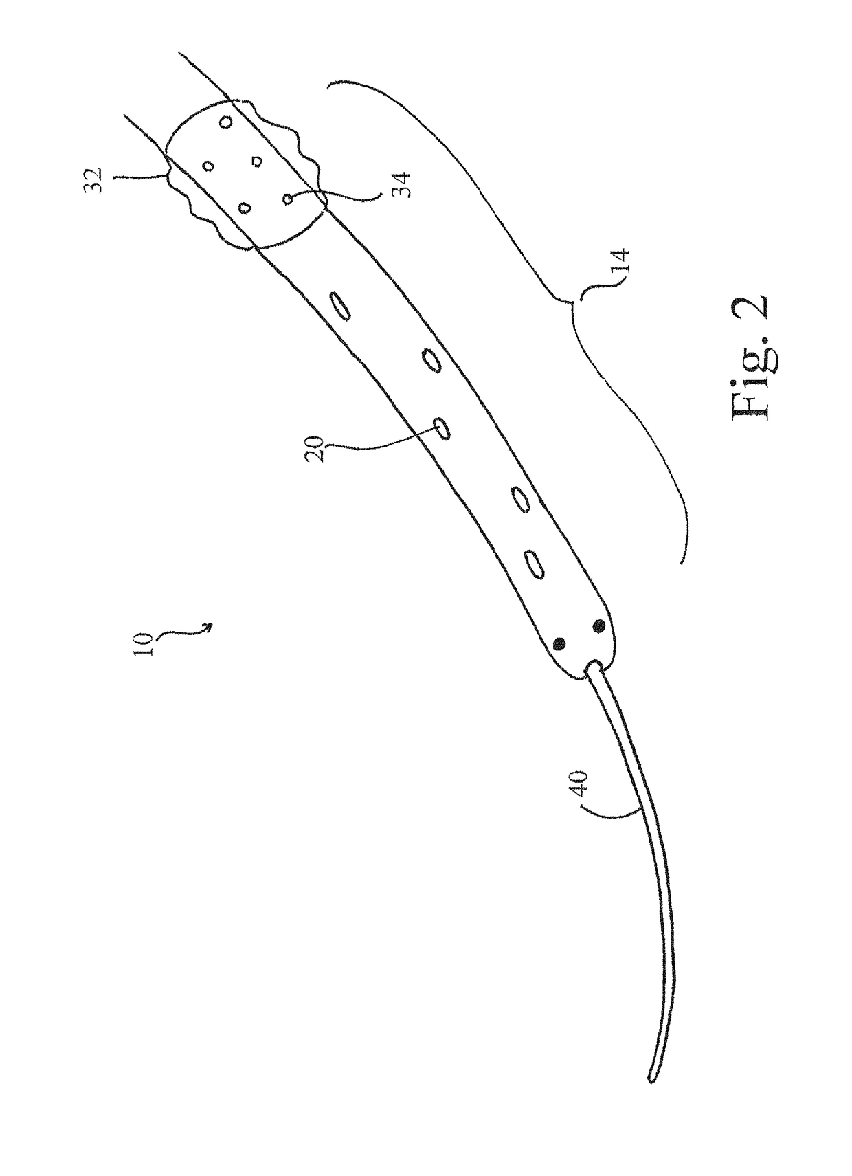 Systems and methods for selective auto-retroperfusion along with regional mild hypothermia