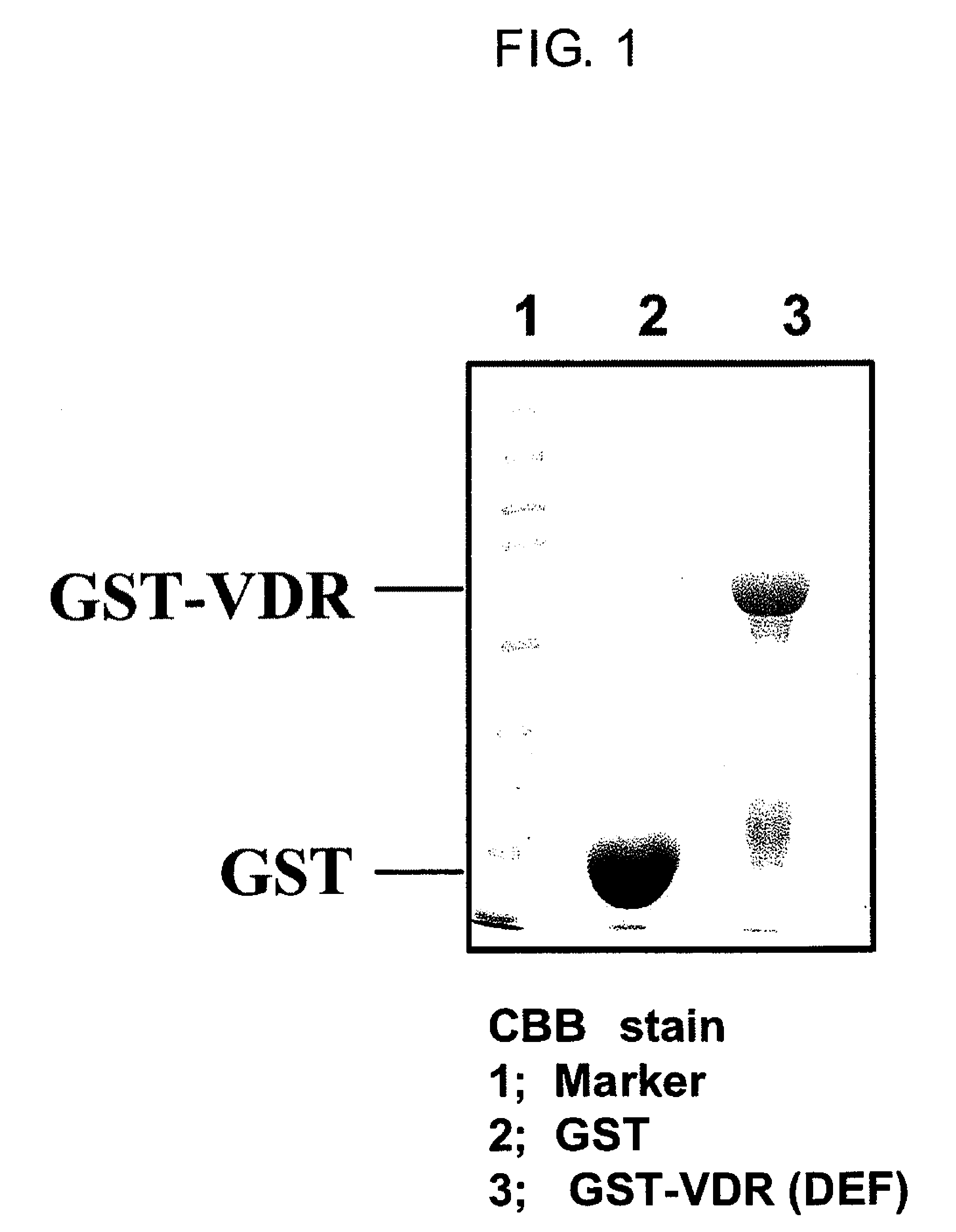 Method for screening for vitamin D receptor ligands