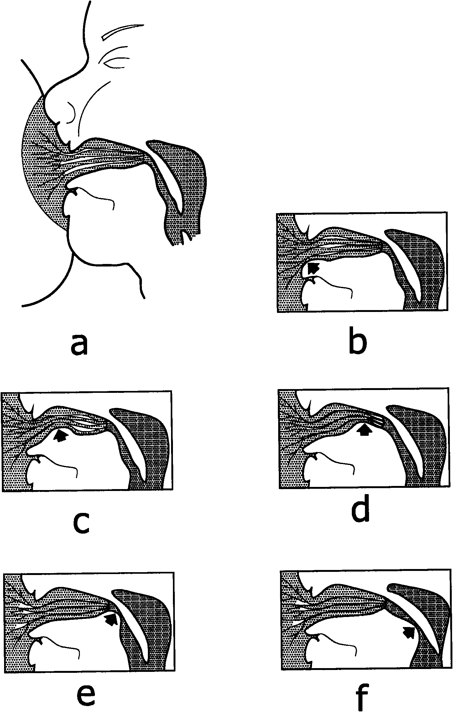 Peristaltic teat