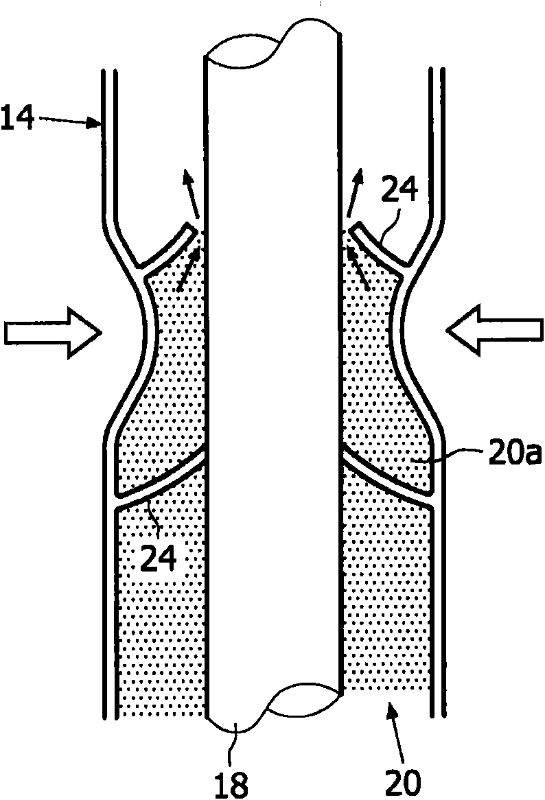 Peristaltic teat