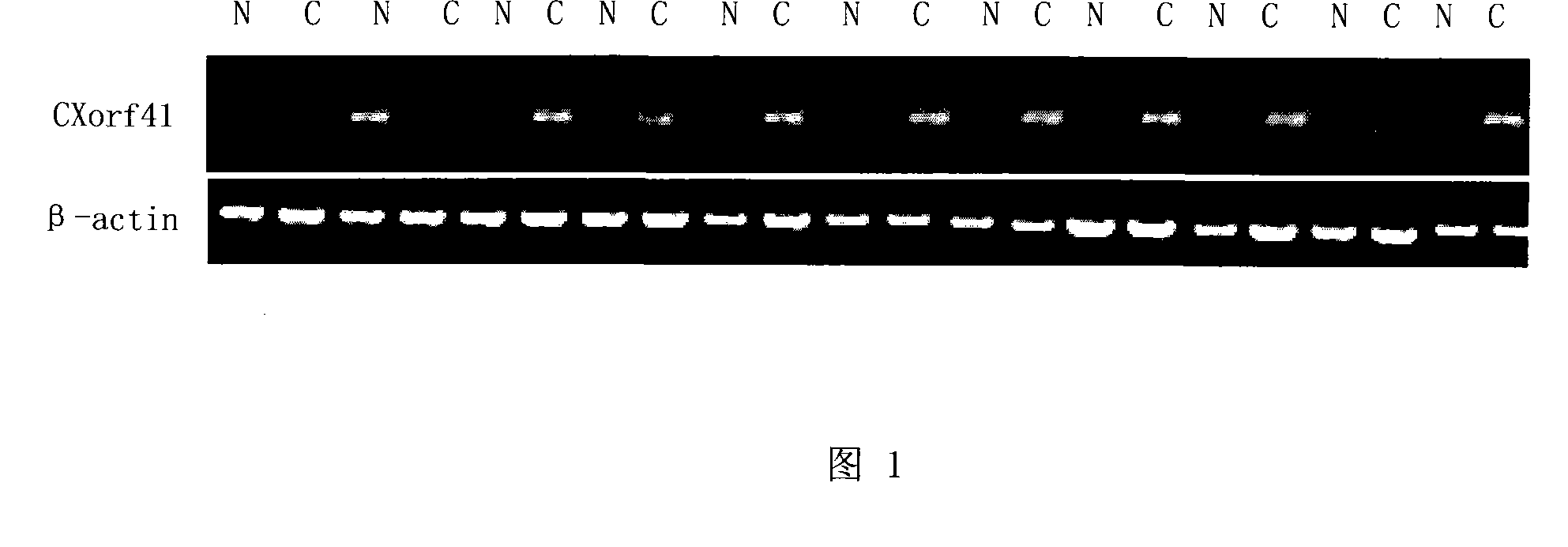 Uses of CXorf41 gene