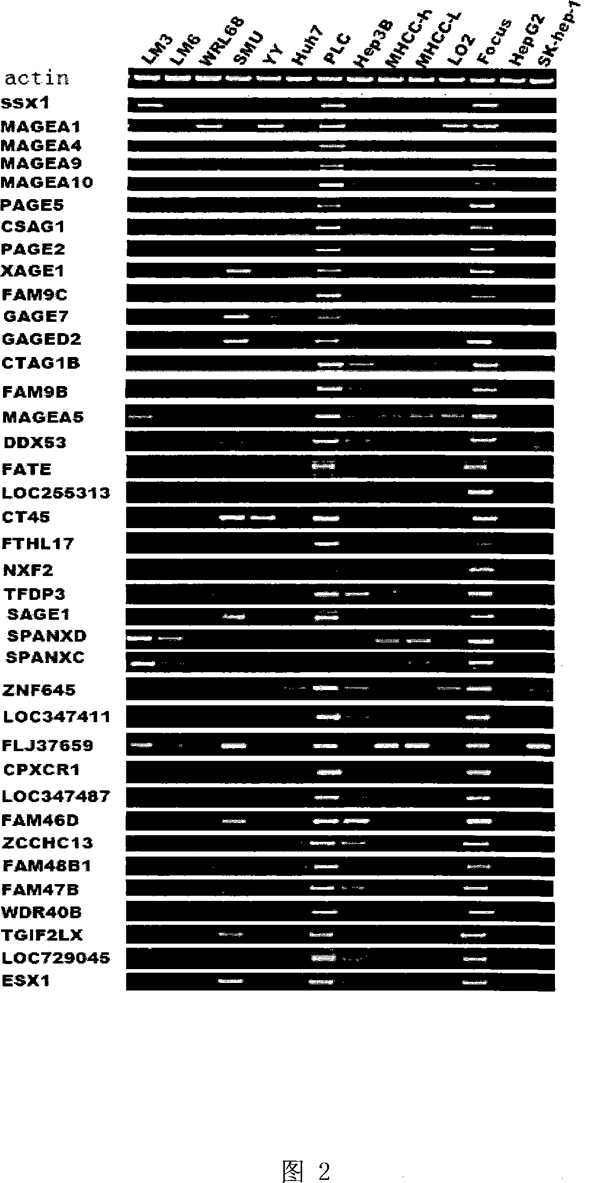 Uses of CXorf41 gene