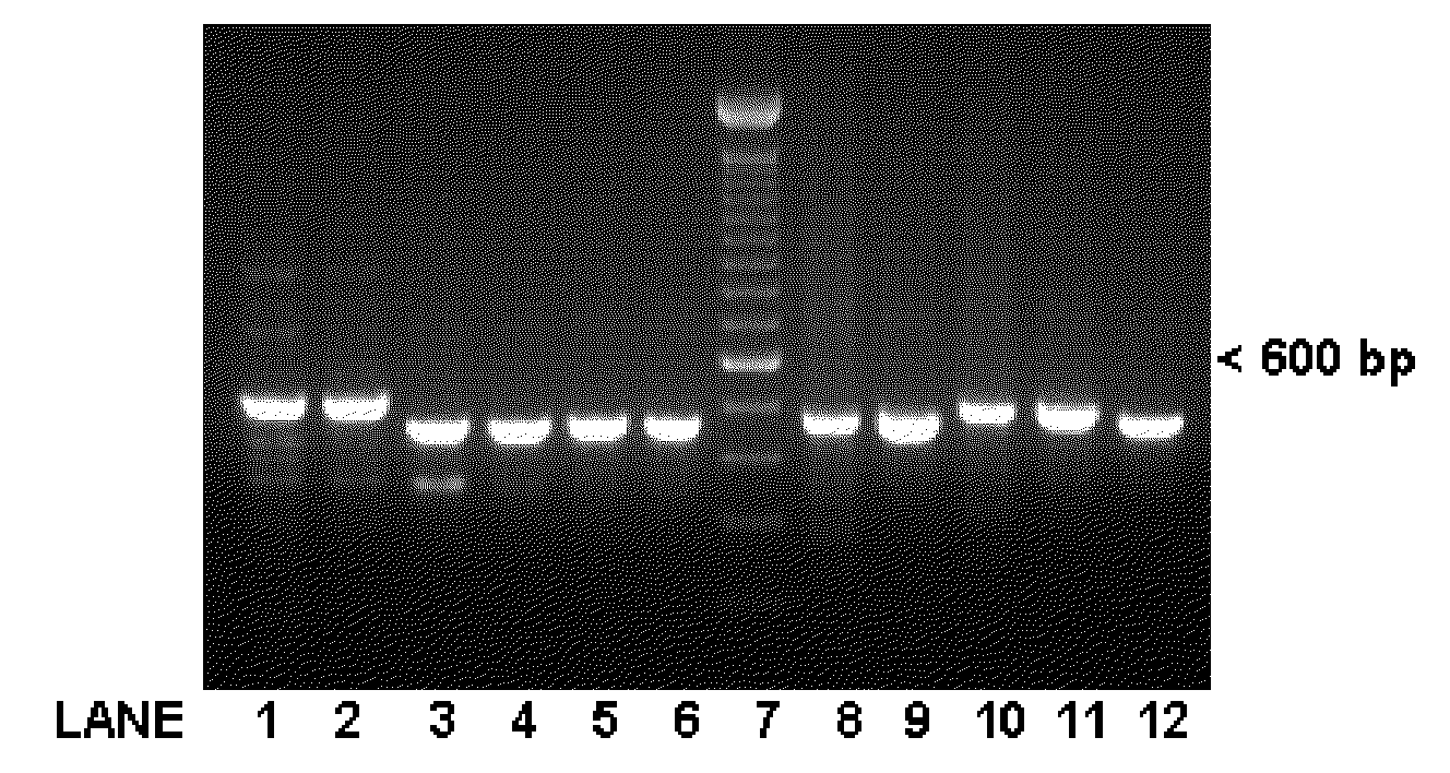 Nucleotide sequence of shrimp actin promoter and its use in genetic transformation biotechnology