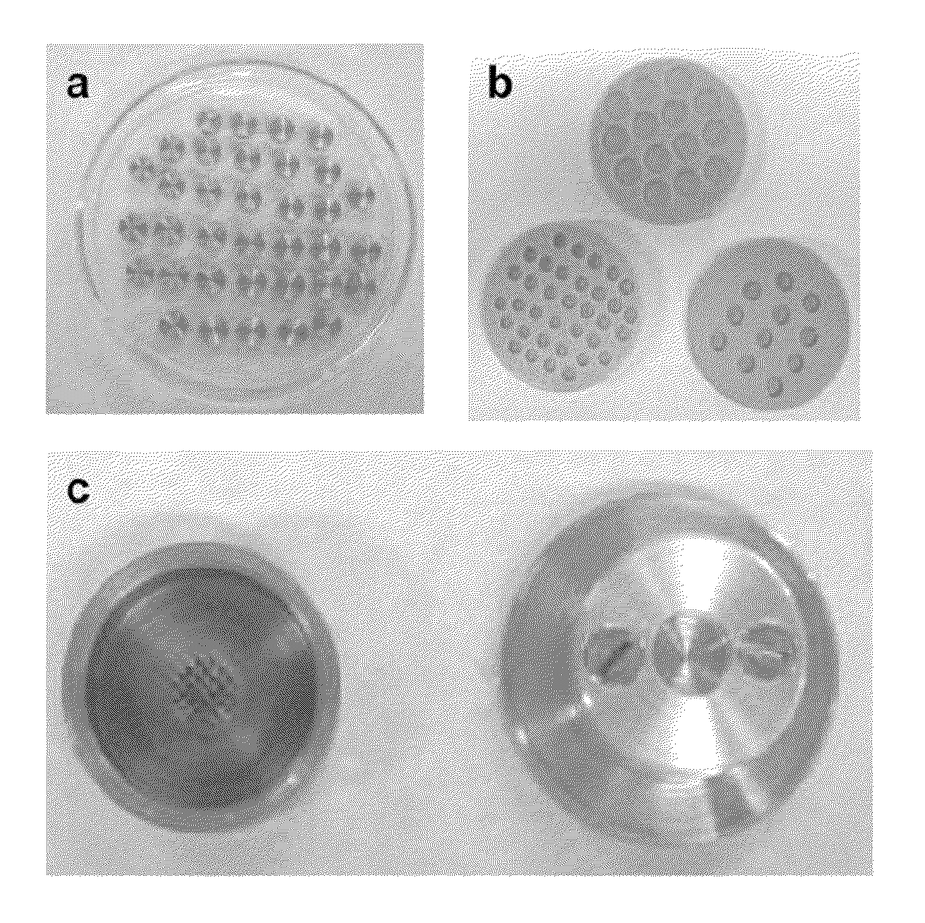 Three-dimensional matrices of structured porous monetite for tissue engineering and bone regeneration, and method of the preparation thereof