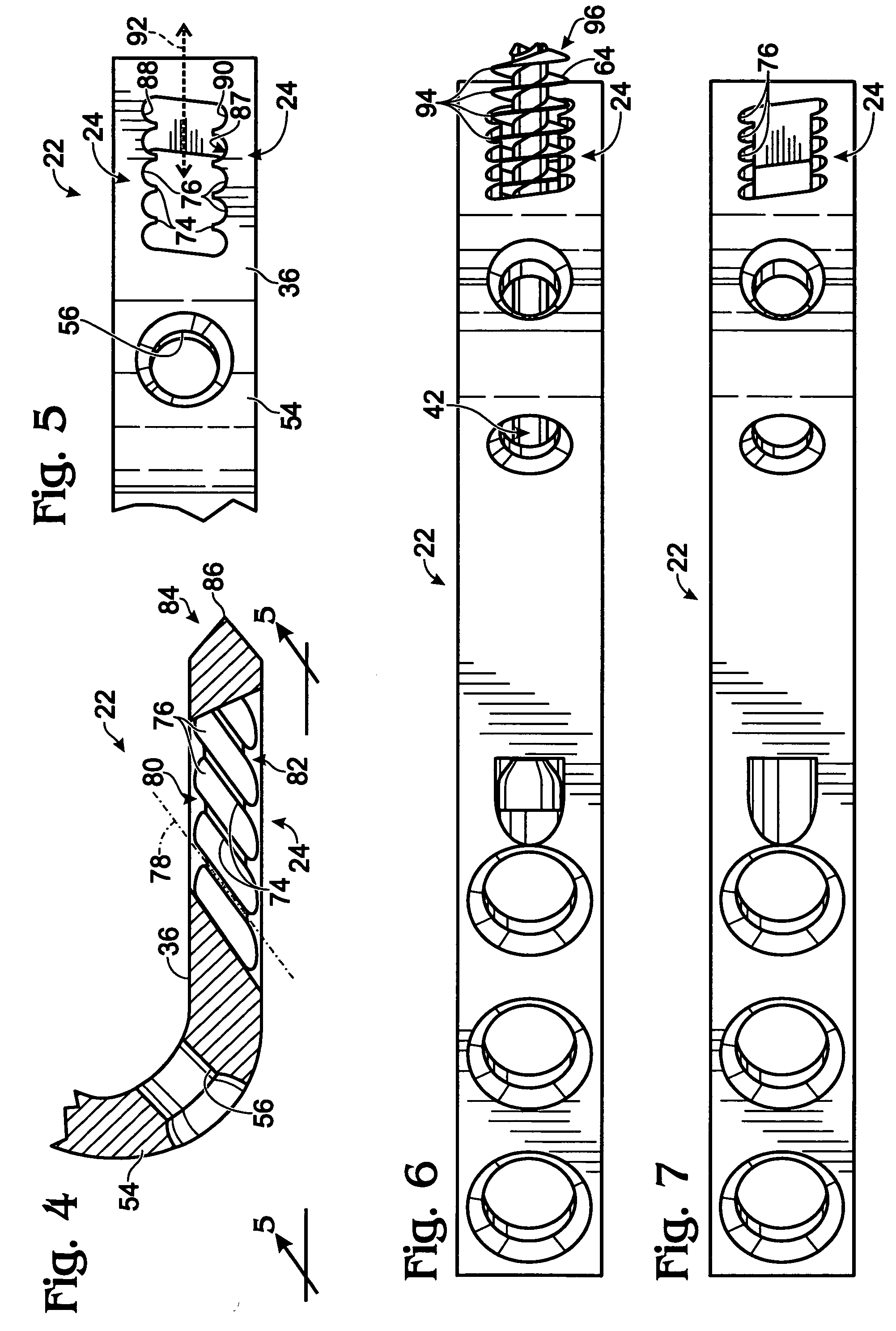 Bone plate with toothed aperture