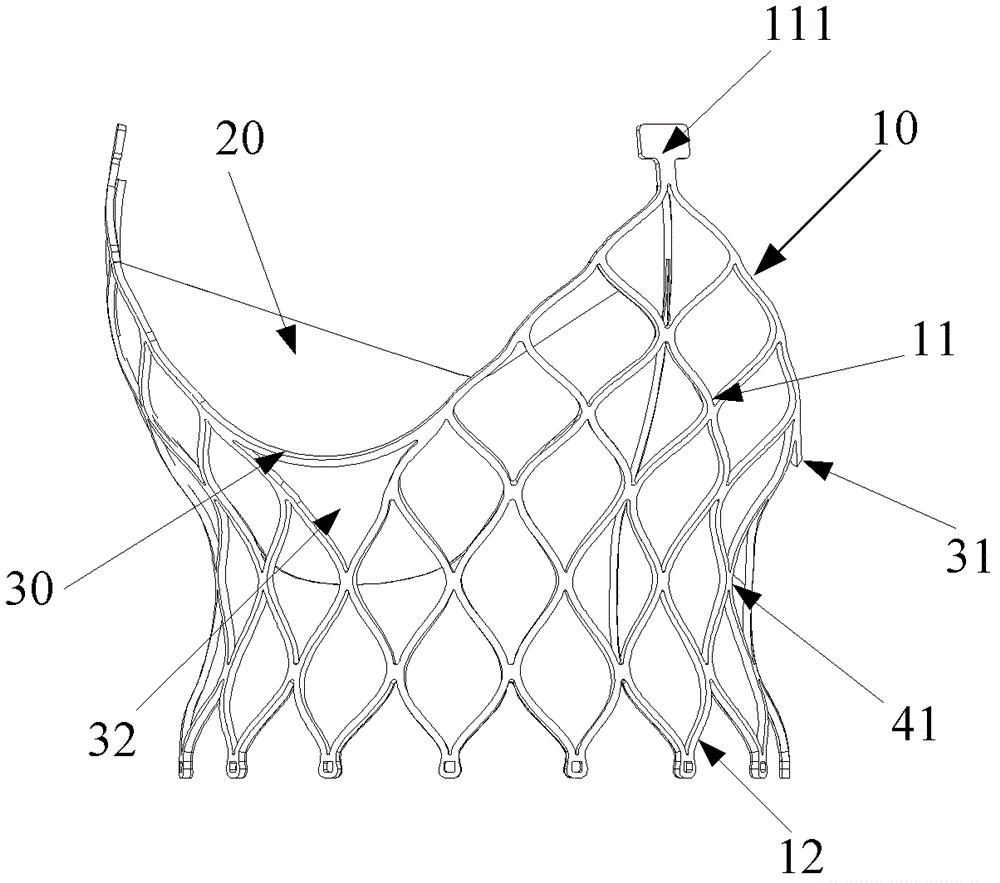 Artificial heart valve and its stent