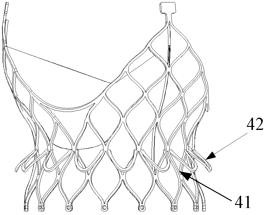 Artificial heart valve and its stent