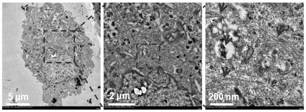 A Polypeptide Liposome Capable of Morphological Transformation in Lysosomes of Tumor Cells