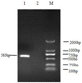 Application of recombinant protein of pathogenic gene vapa of Rhodococcus equi