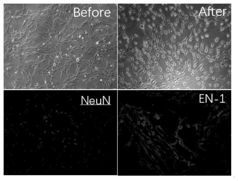 Application of frontal bone mesenchymal stem cells in treatment and/or prevention of animal traumatic brain injury