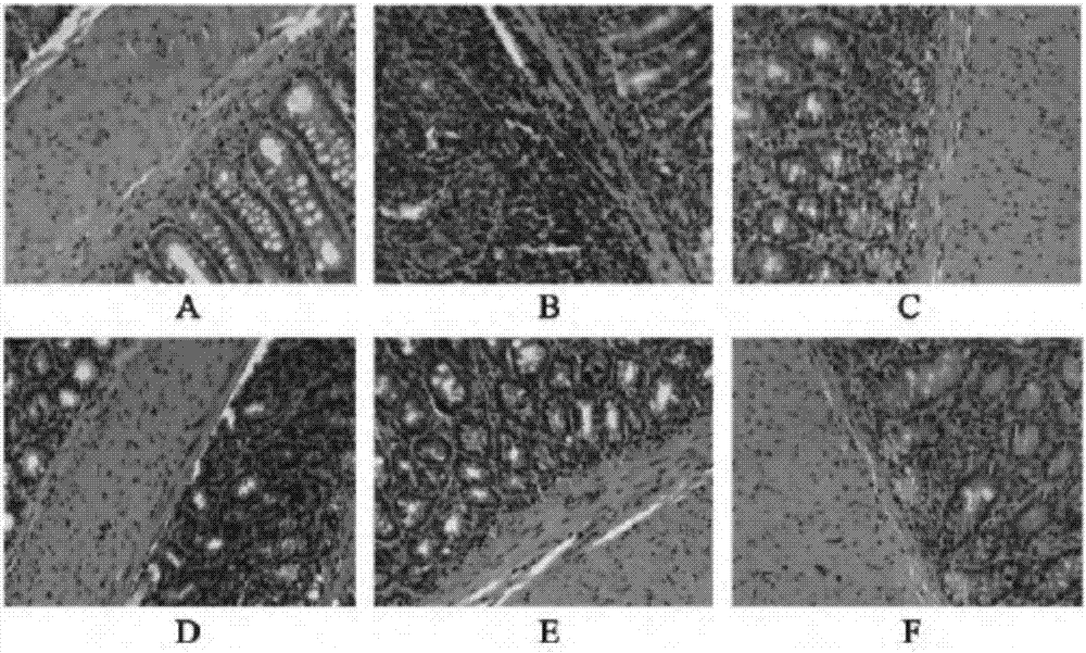 Pharmaceutical composition for treating ulcerative colitis