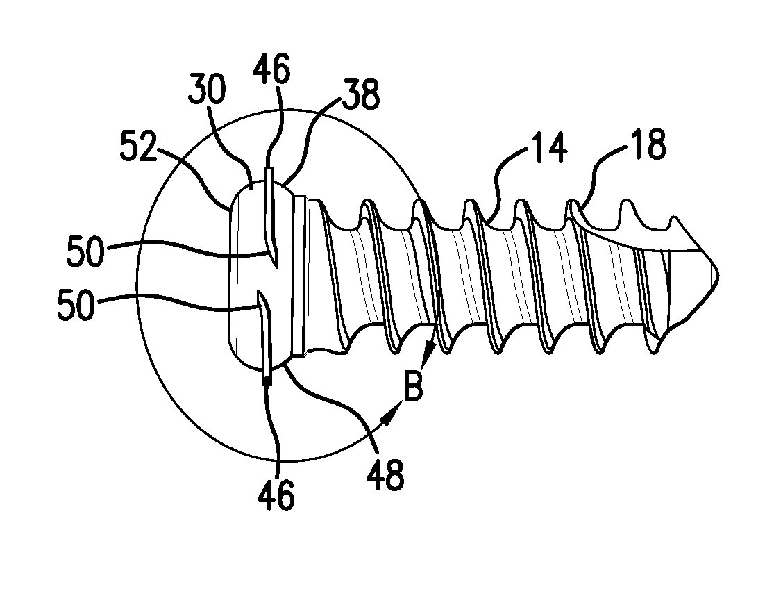 Anterior vertebral plate with quick lock screw