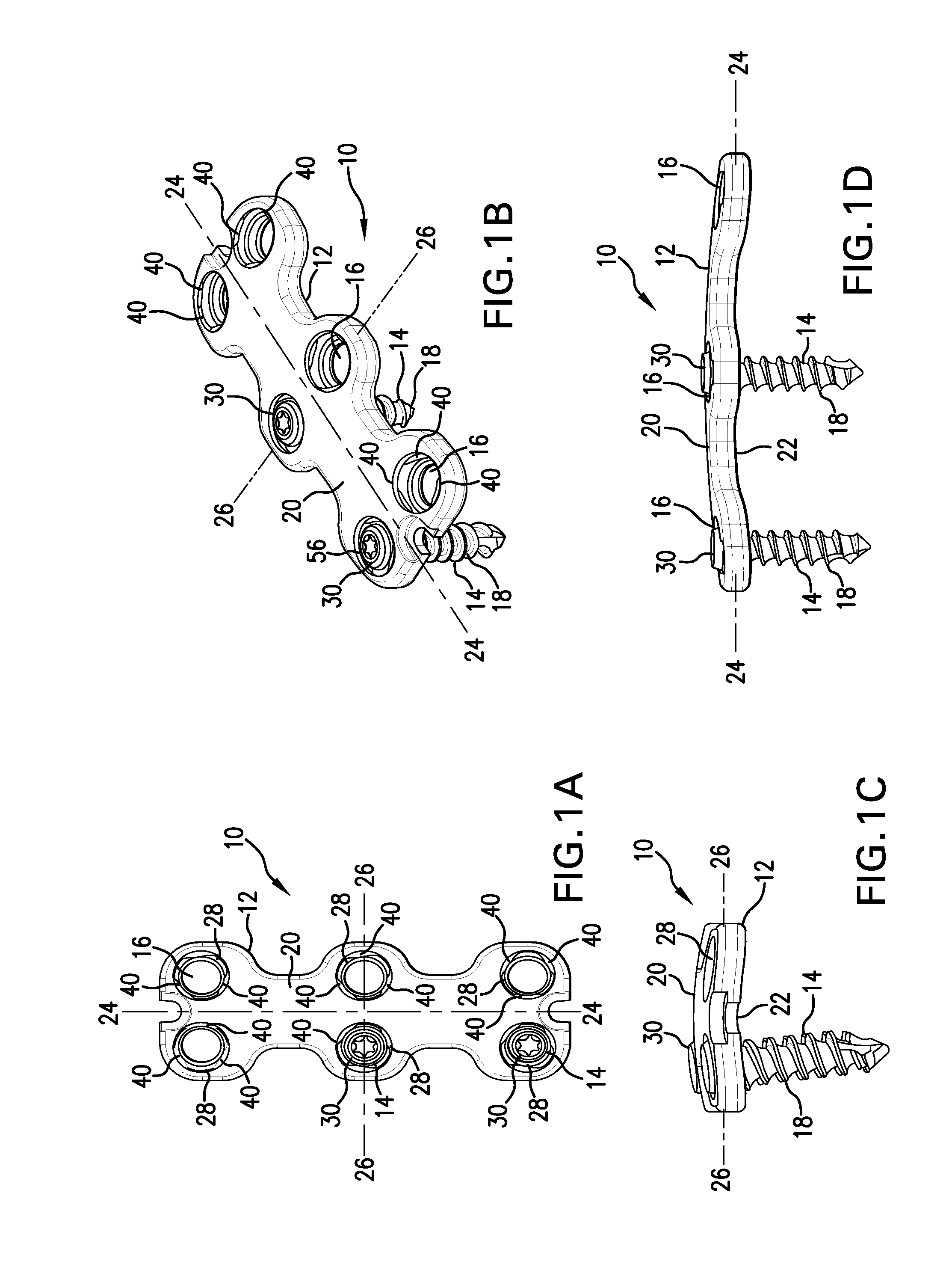 Anterior vertebral plate with quick lock screw