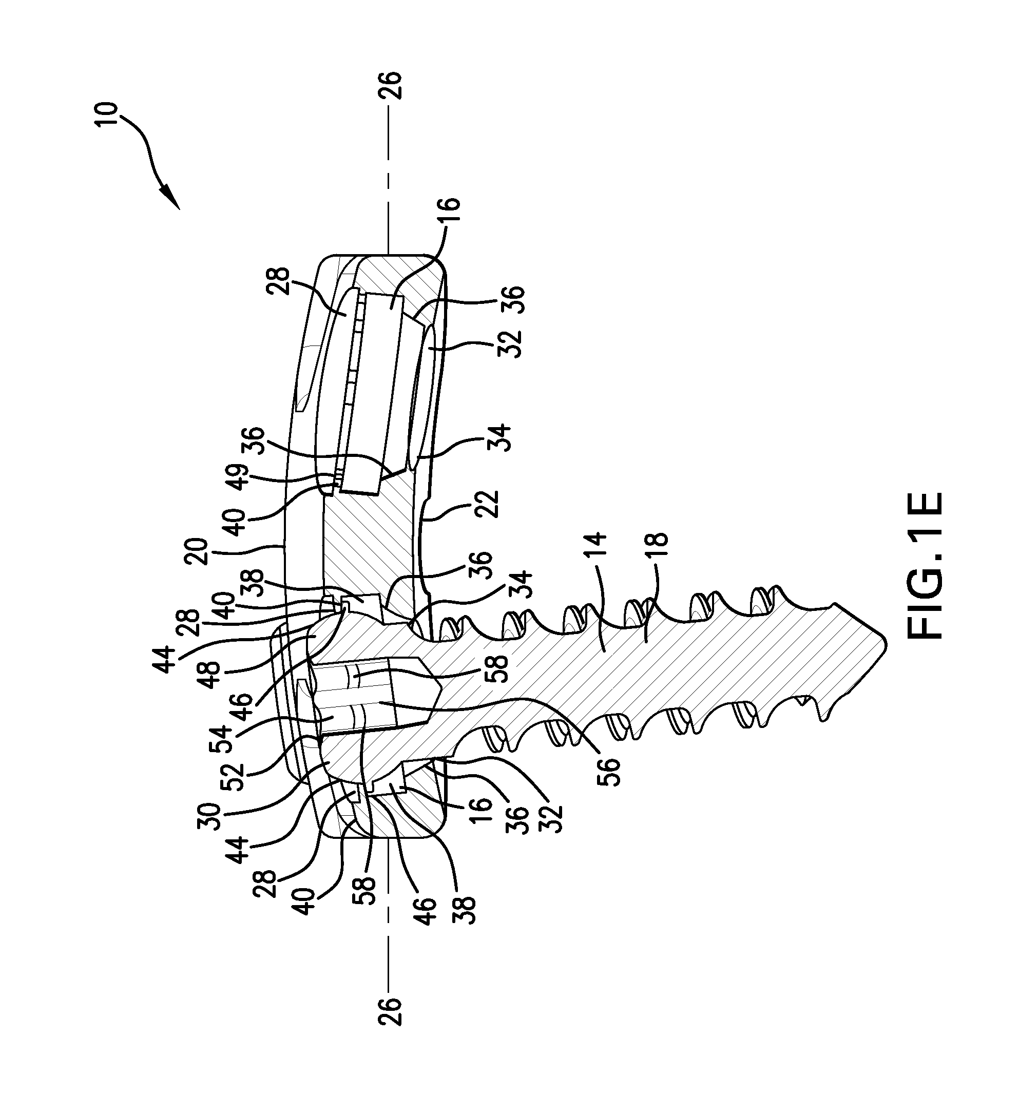 Anterior vertebral plate with quick lock screw