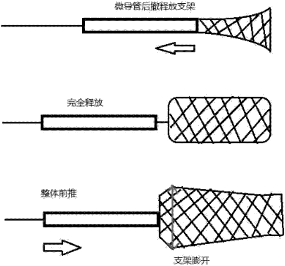 Novel cerebral thrombus removal device and method for removing thrombus by using device