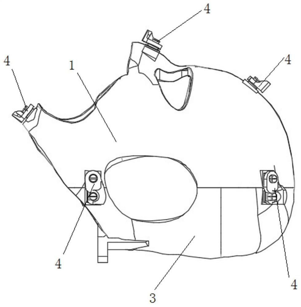 A positioning head mold and three-dimensional imaging and molding system for gamma knife surgery