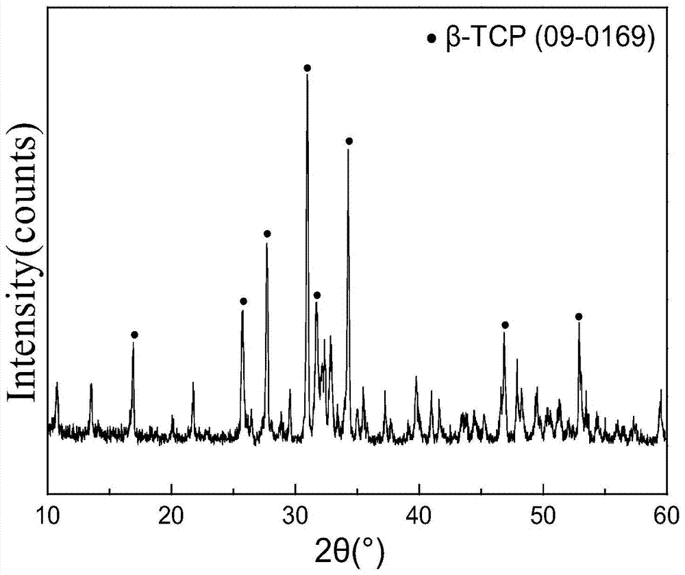 A kind of microemulsion synthetic method of mesoporous β tricalcium phosphate