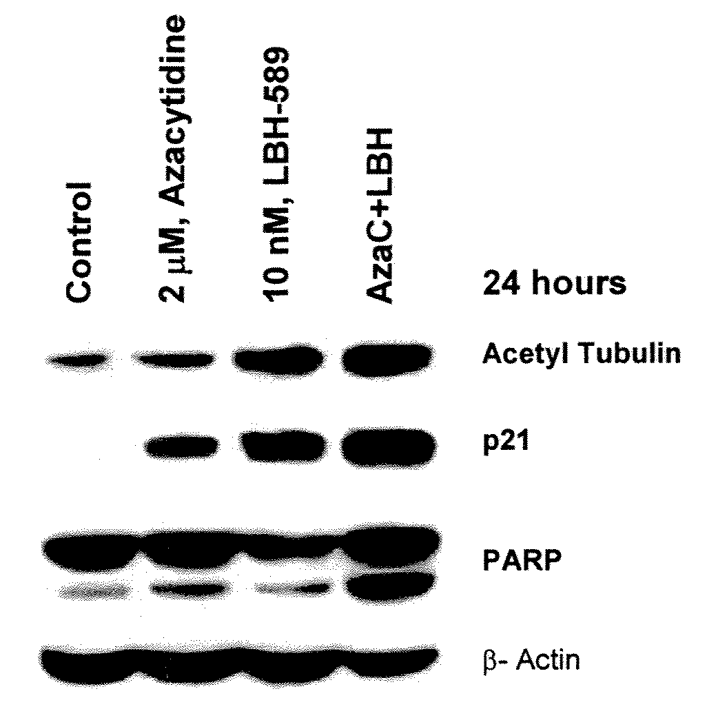 Combination of an HDAC inhibitor and an antimetabolite