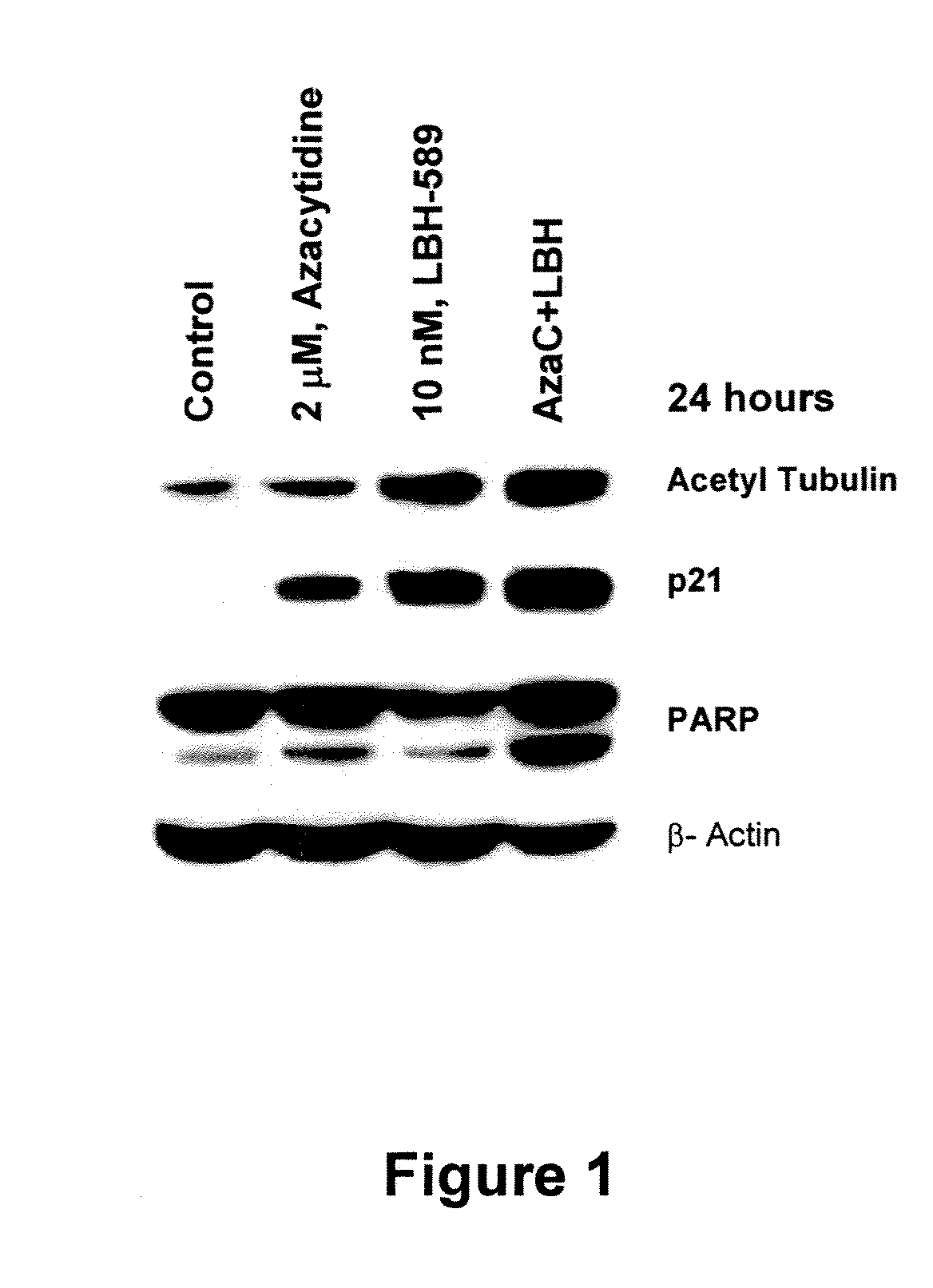 Combination of an HDAC inhibitor and an antimetabolite