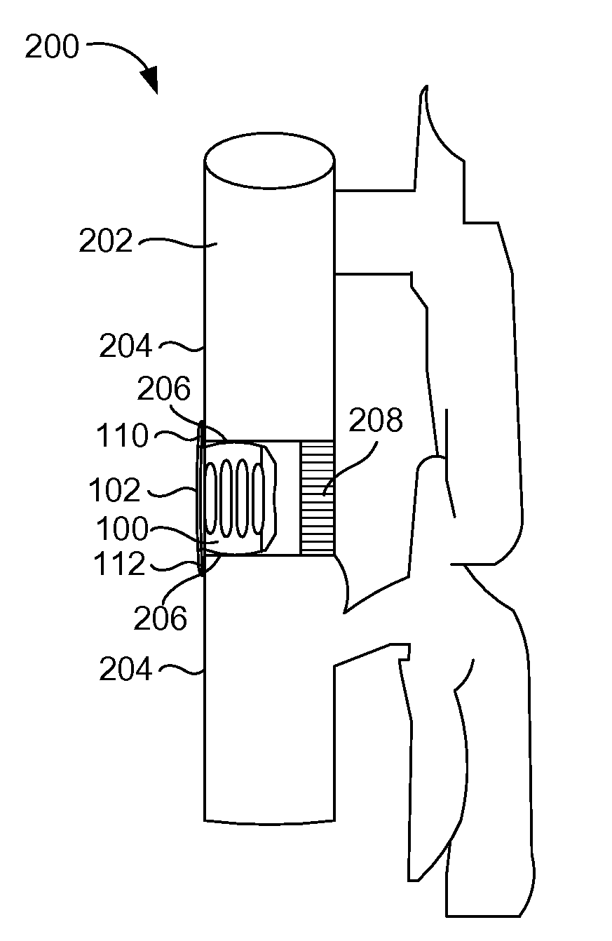 Flanged interbody device