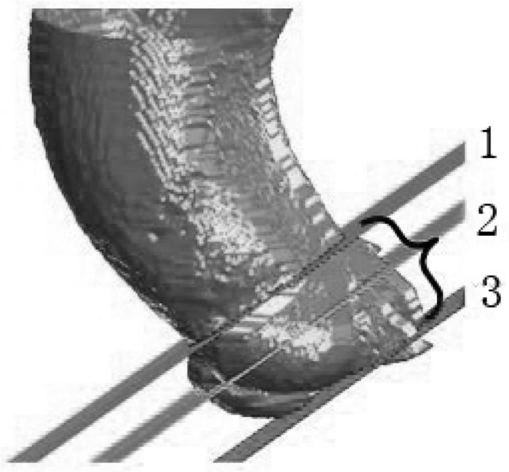 A method for measuring anatomical features of aortic complex