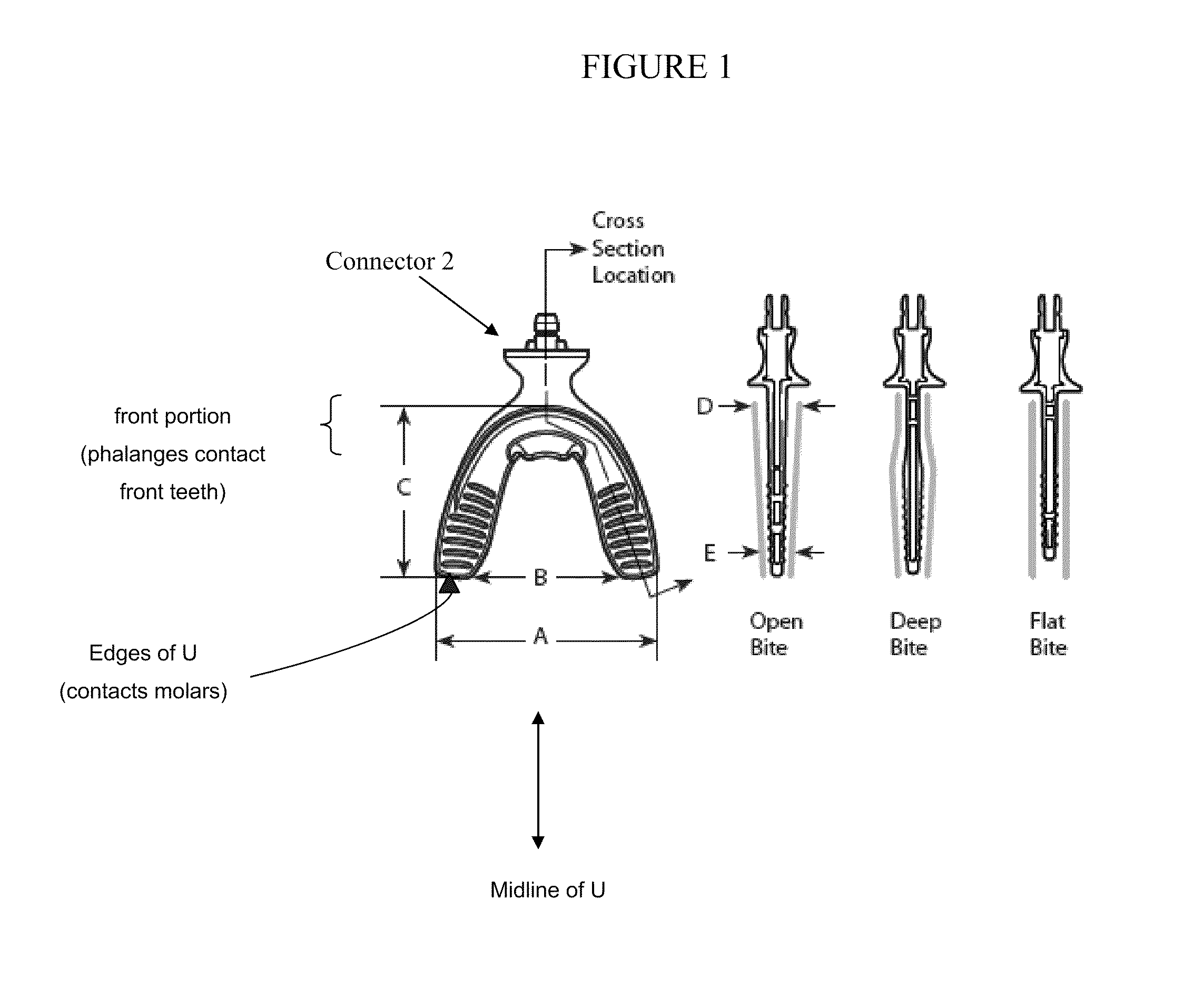 Vibrating dental devices