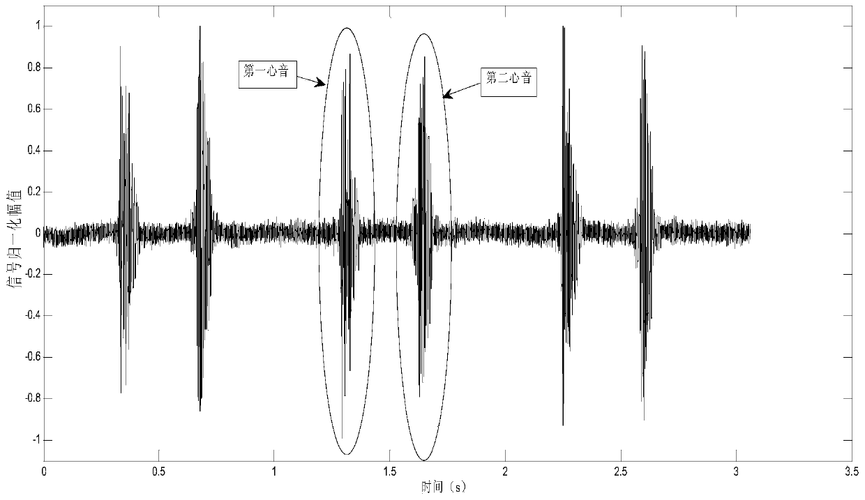 A Heart Rate Calculation Method Based on Autocorrelation Analysis of Heart Sound Signals