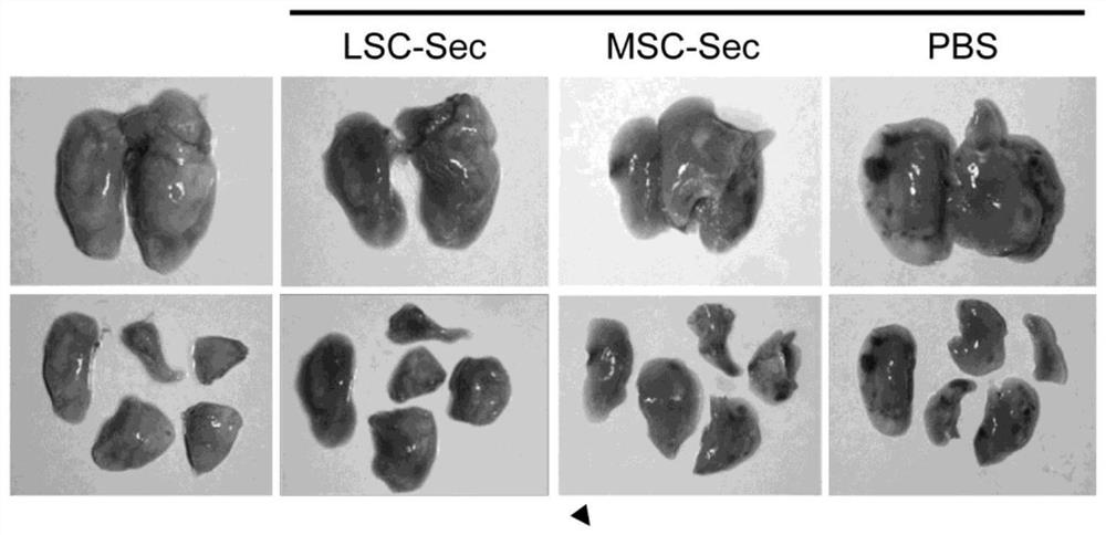 Therapeutic lung repair by inhalation of lung spheroid cell-secreted factors